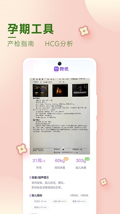 她抚孕育app