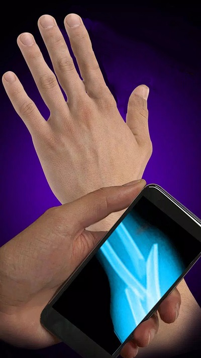 x射线模拟器-手机x光整蛊