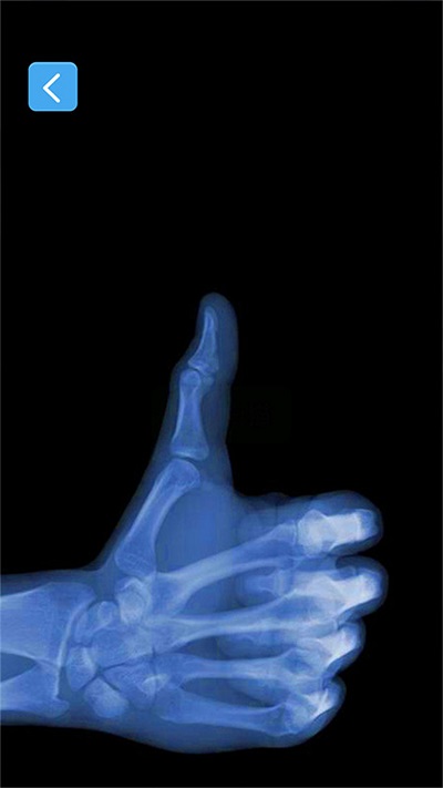 x射线模拟器-手机x光整蛊