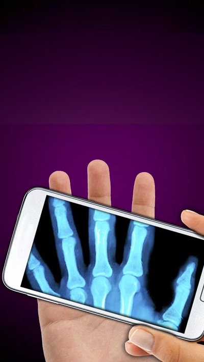 X光模拟器——手机X光恶搞 X光模拟器手机版下载