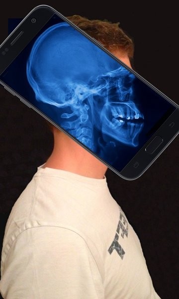 x射线身体扫描模拟器软件 x射线身体扫描模拟器中文版下载